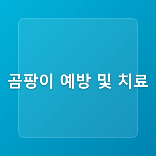 다육이 키우는법12월 관리는 이렇게